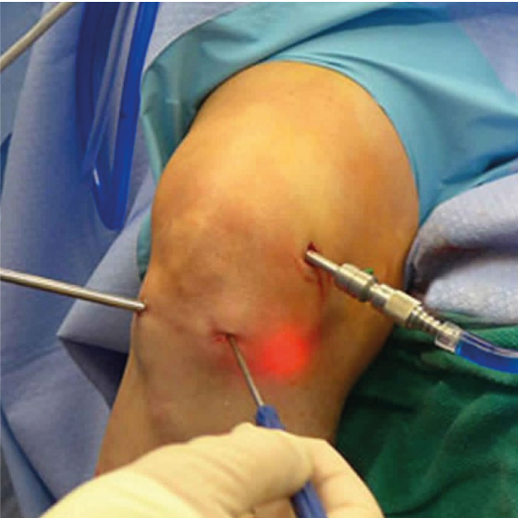 artroscopoia_clinica_traumatologia
