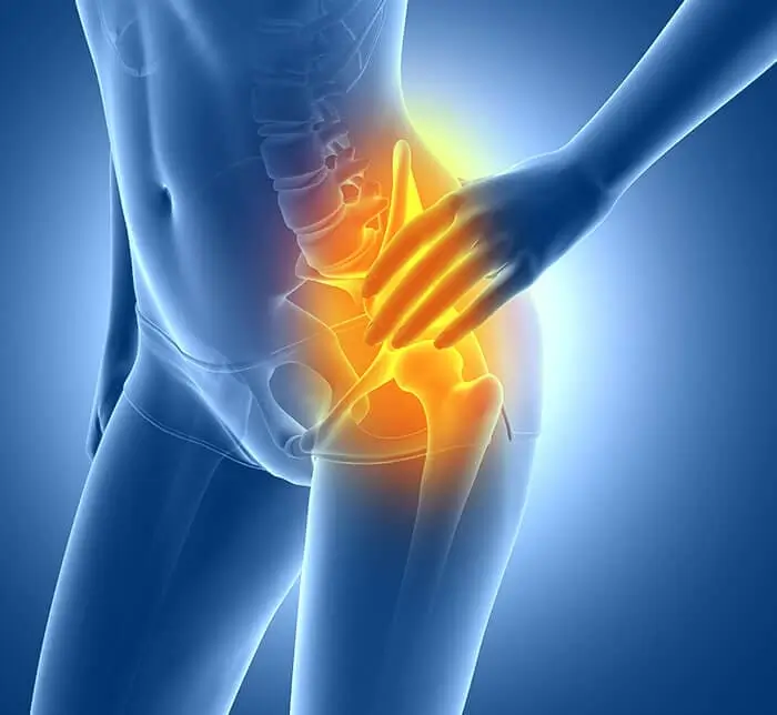 lesion_cadera_traumatologia