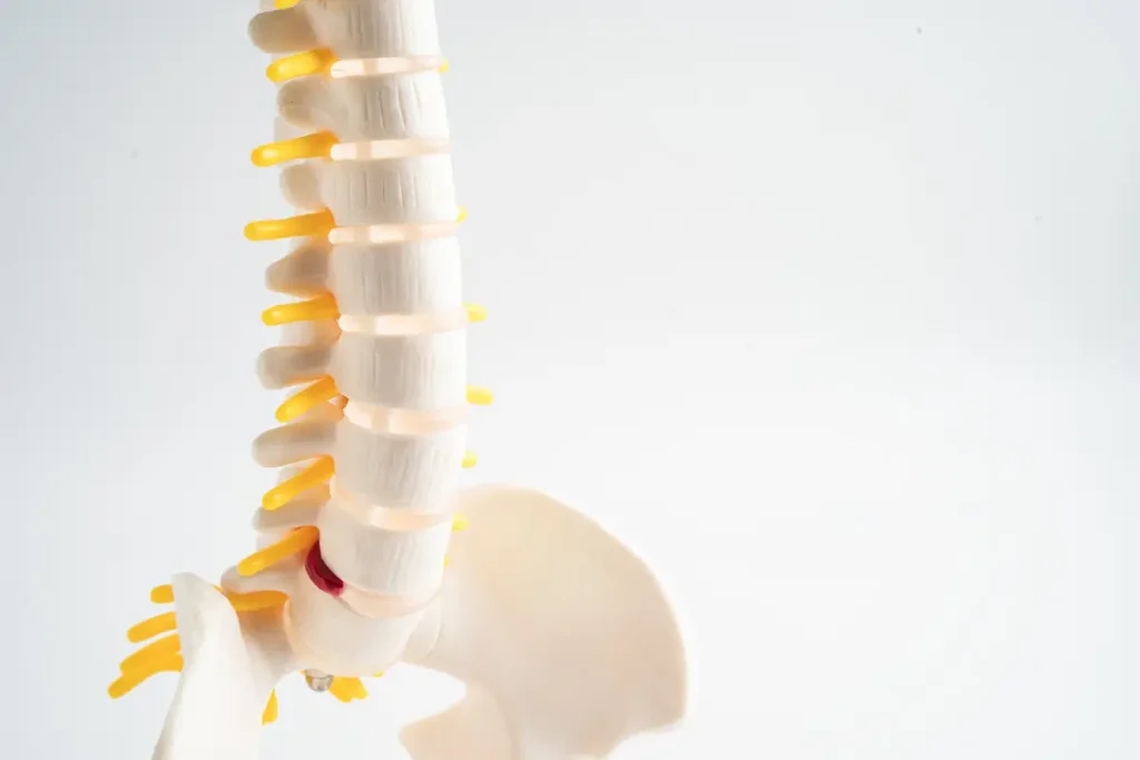 Clínica de Traumatología Quirúrgica | dolor en la espalda,columna vertebral,zona lumbar,ejercicio para espalda Ilustración de la columna vertebral sana y dañada