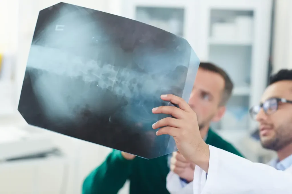 Clínica de Traumatología Quirúrgica | dolor en la espalda,columna vertebral,zona lumbar,ejercicio para espalda Médico revisando una radiografía de hernia discal