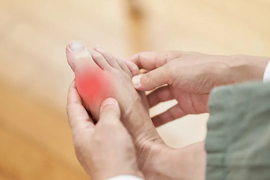 Ejercicios preventivos para evitar que es un juanete en deportistas - clínica de traumtología quirúrgica