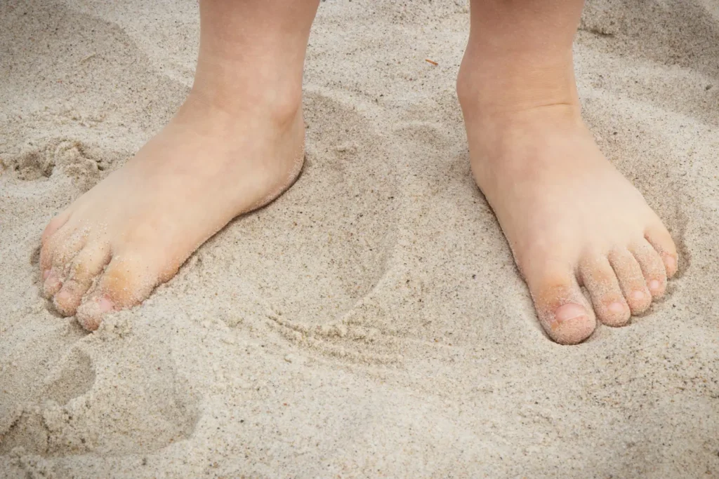 Niño con pie plano caminando descalzo sobre la arena - clínica de traumatología quirúrgica