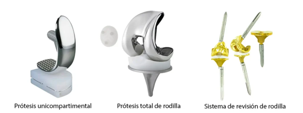 Tipos de protesis de rodilla- clinica de traumatologia quirurgica