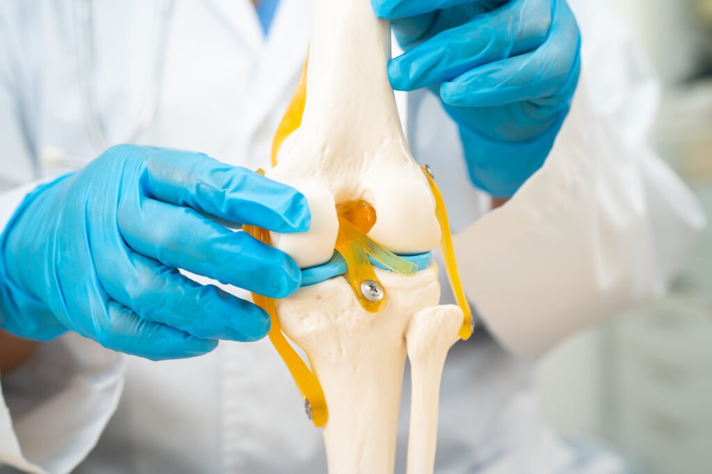 Lesion de meniscos - clínica de traumatología quirúrgica