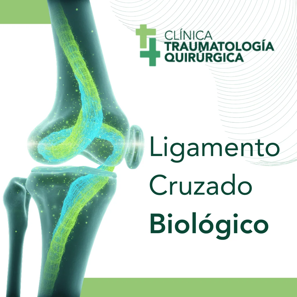 Clínica de Traumatología Quirúrgica | igamento cruzado biológico,reconstrucción LARS,ligamento artificial rodilla,cirugía LCA Quito,ligamento cruzado anterior