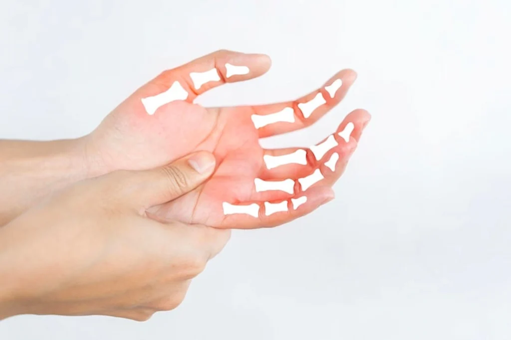 Clínica de Traumatología Quirúrgica | fractura de metacarpiano,fracturas de metacarpianos,fractura de 4to metacarpiano,fractura de 5 metacarpiano,fractura de la mano rehabilitación tras fractura de la mano - Clínica de Traumatología Quirúrgica