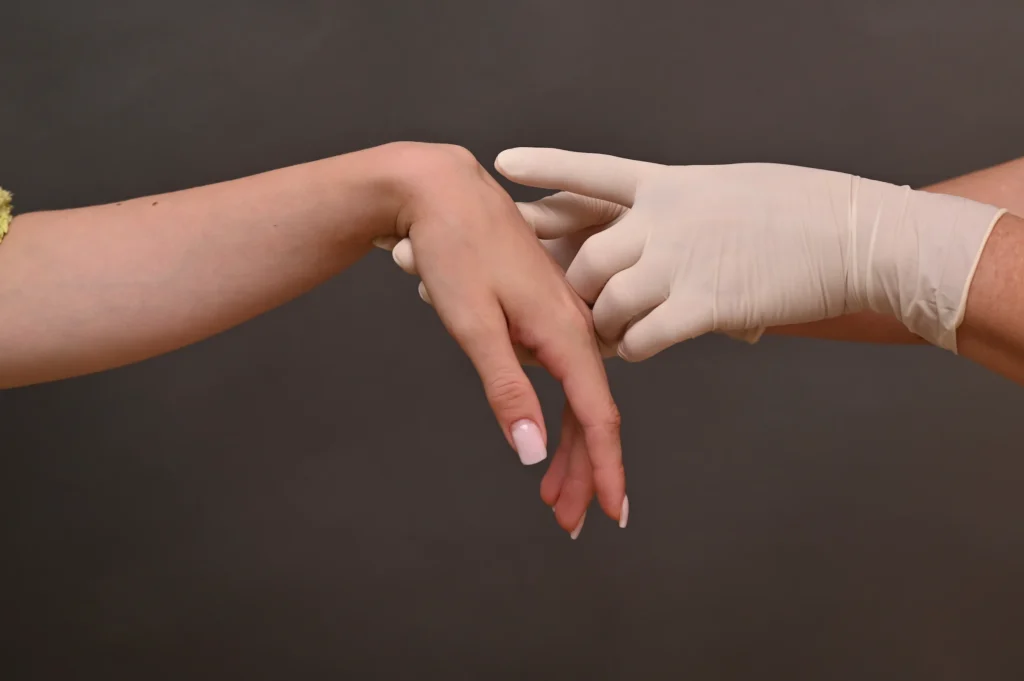 fractura de muñeca - clinica de traumatologia quirurgica