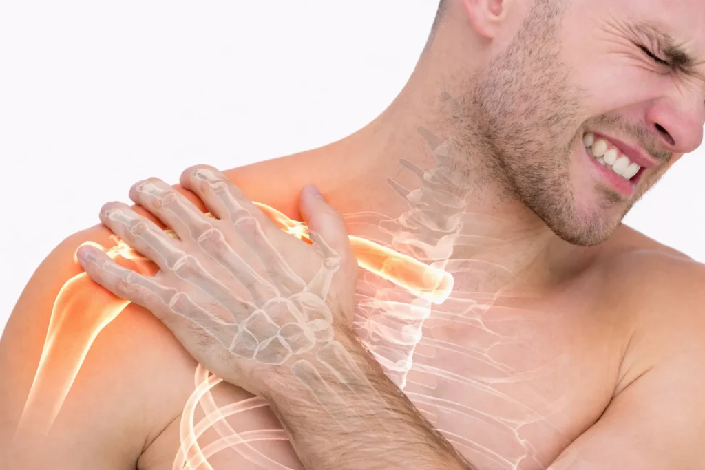 fractura de clavicula - clinica de traumatologia quirurgica